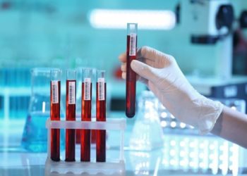 9 ГЛАВНЫХ показателей крови, которые расскажут о здоровье